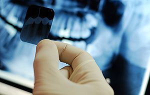 Цифровые стоматологические рентгенограммы